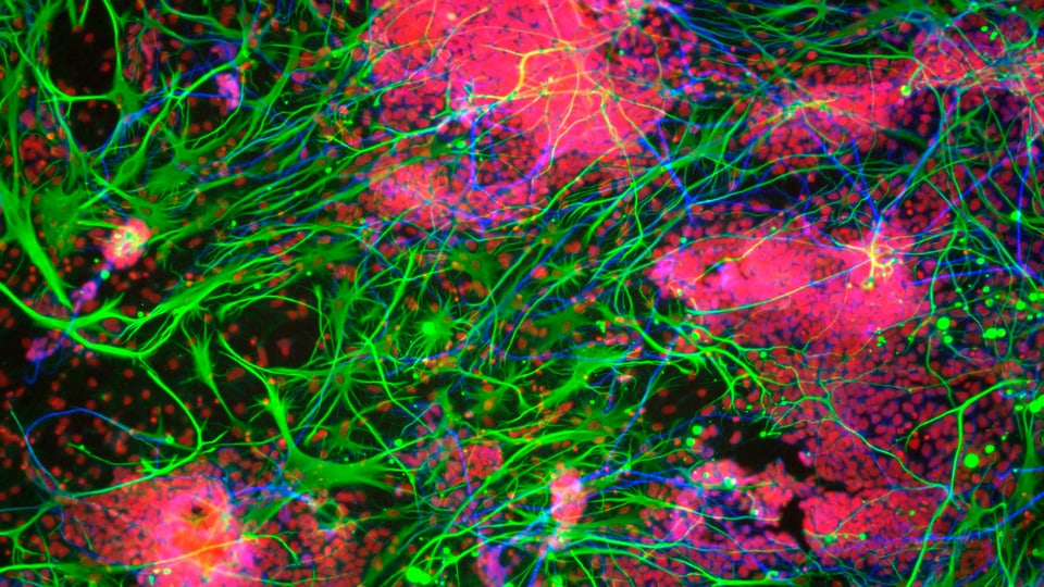Nervenzellen in Grün, partiell überlagert von Wolken in Pink.