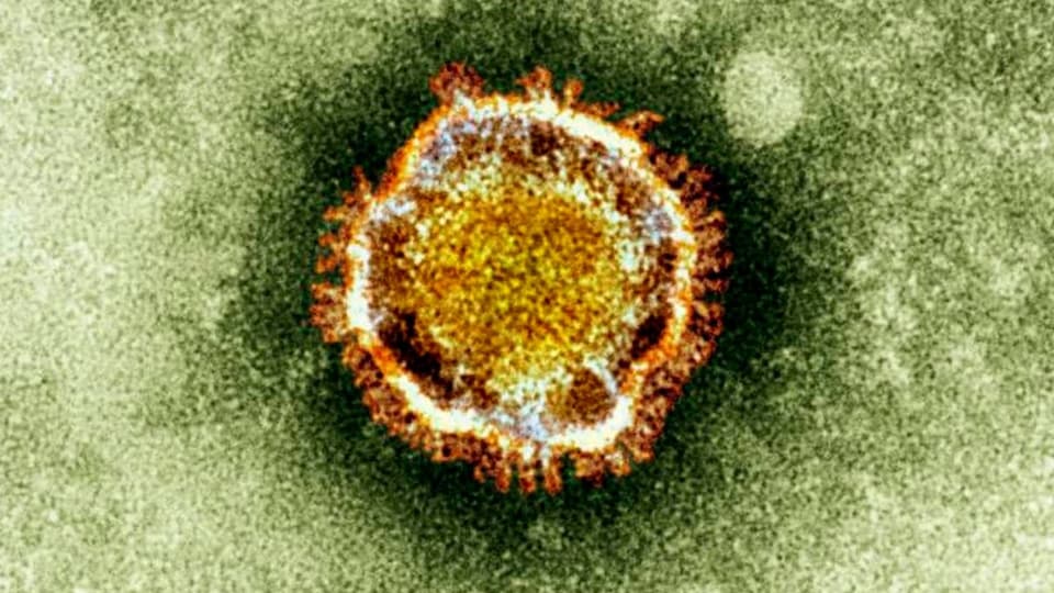 Elektronenmikroskop-Aufnahme eines Coronavirus