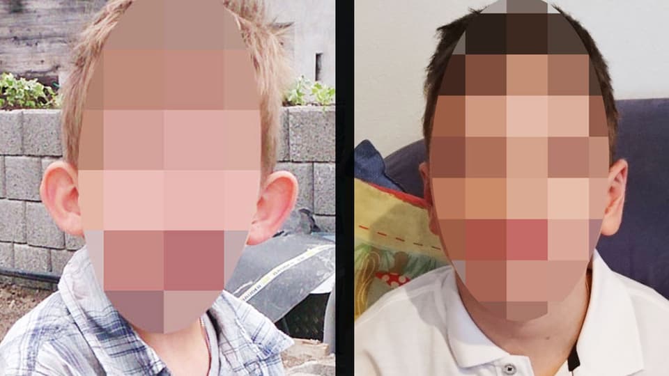 Porträt eines Jungen, vor und nach der Ohr-Operation.