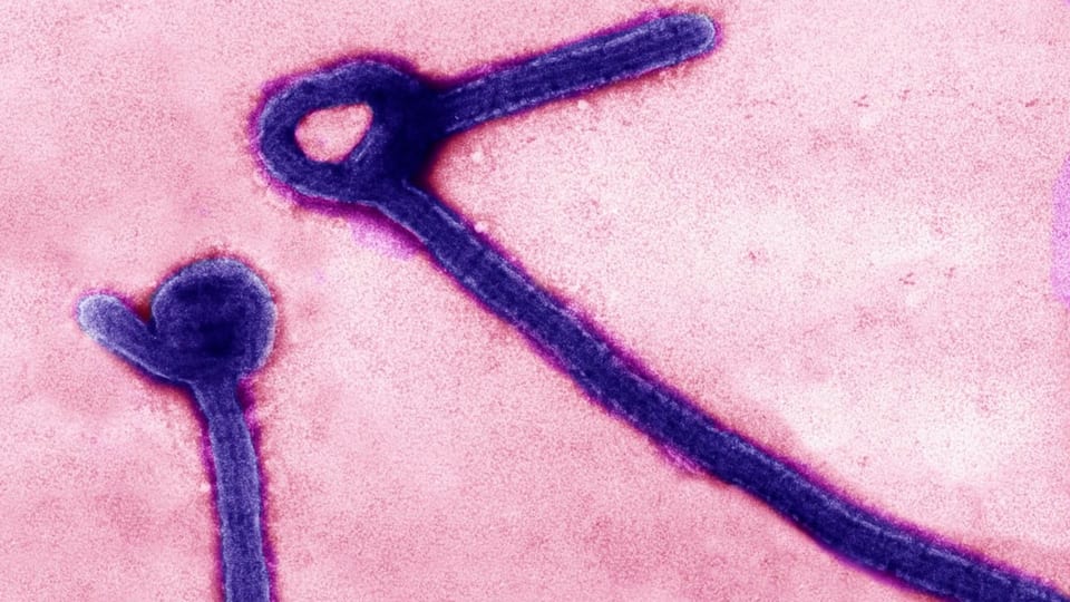 Vergrösserte Ebolaviren: Zwei violette, Stäbchen-artige Gebilde mit Verknotungen auf rosa Hintergrund