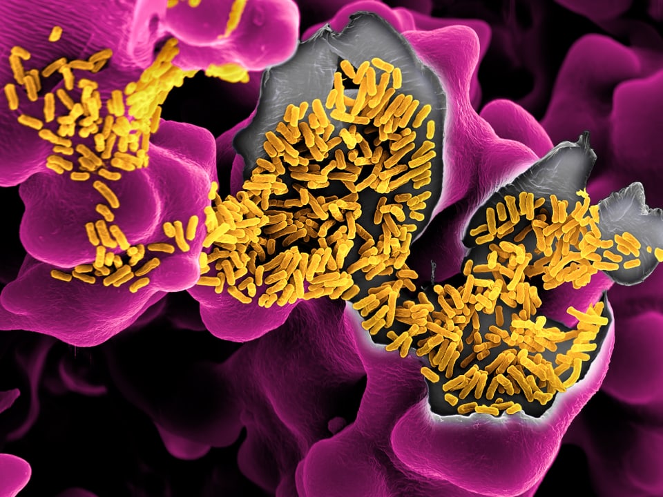 Bakterien sehen aus wie violette Korallen in der Mitte gelb getupft. 