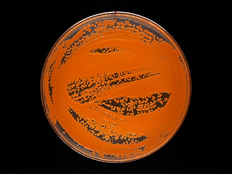 Petrischale mit orangem Pilz