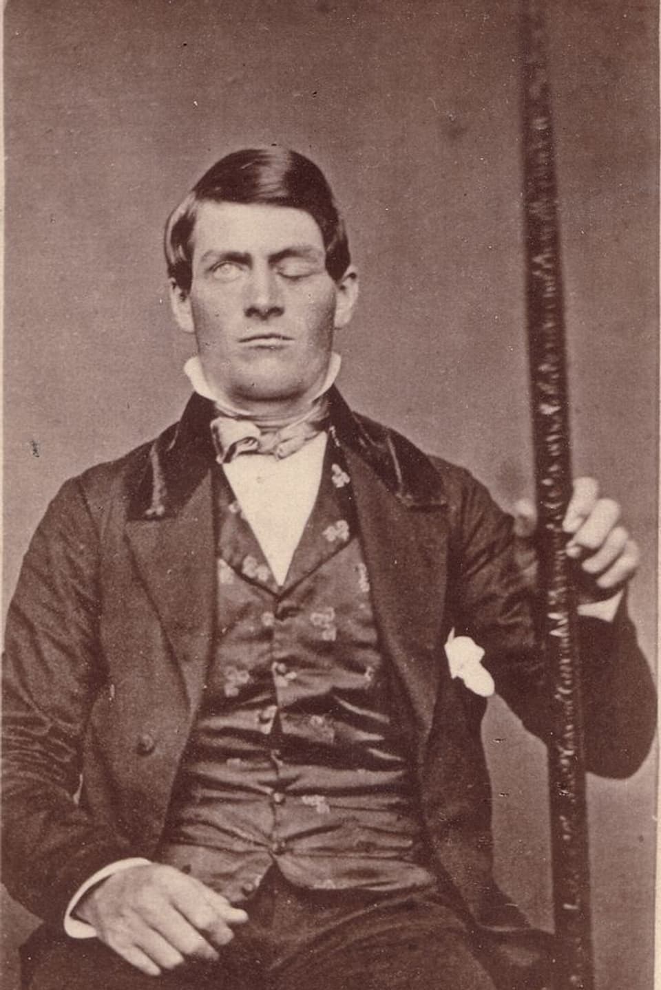 Historische Aufnahme eines Einäugigen mit einer langen Eisenstange in der linken Hand.