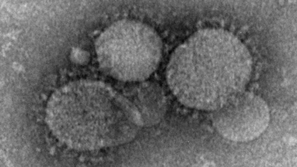 Teile des Mers-Virus, aufgezeichnet mit einem Elektronenmikroskop.
