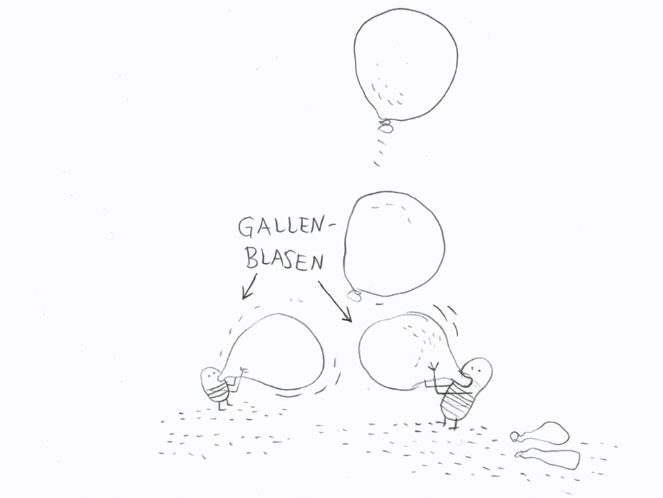 Illustration von Gallenblasen.