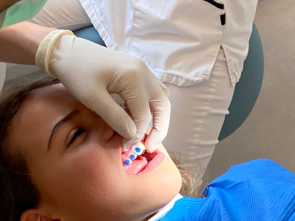 Säure auf Zahn
