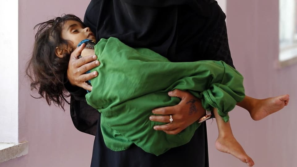 Unterernährtes Kind in Spital im Jemen