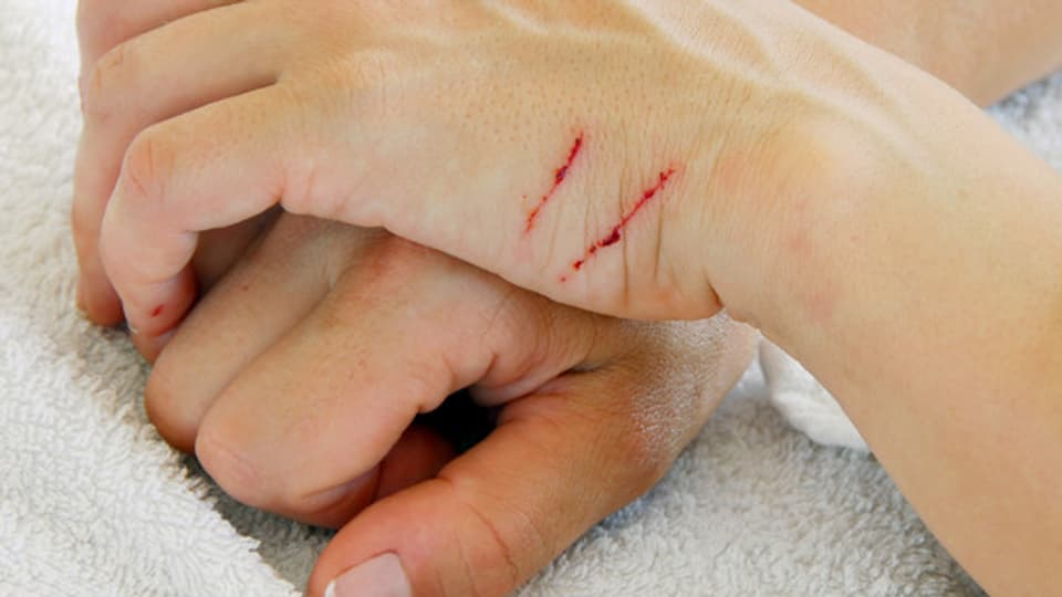 Was Soll Ich Tun Bin In Nagel Getreten Medizin Unfall