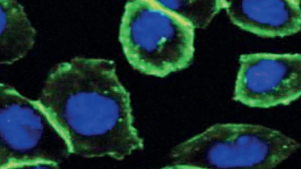 Blaue Zellen mit grünem Rand