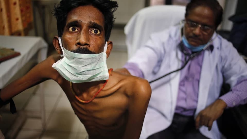 Tuberkulose-Patient in Indien