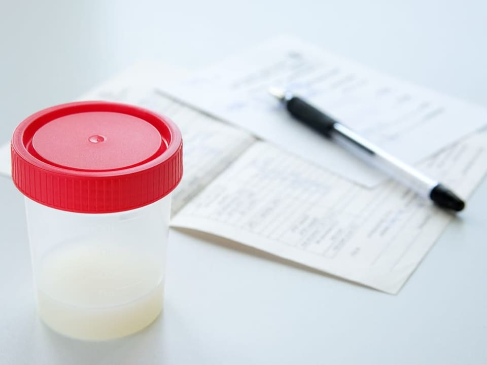 Plastikdose mit Sperma neben einem ausgefüllten Formular 