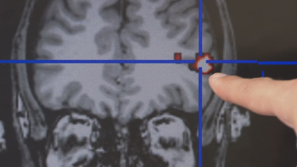 Aufnahmen aus einem Hirnscanner, die zeigen, welche Region während des Versuchs aktiv ist.