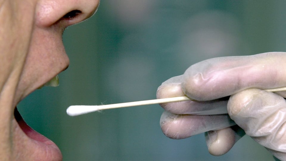 Symbolbild: Hand mit Wattestäbchen nimmt DNA-Probe ein einem aufgesperrten Mund.