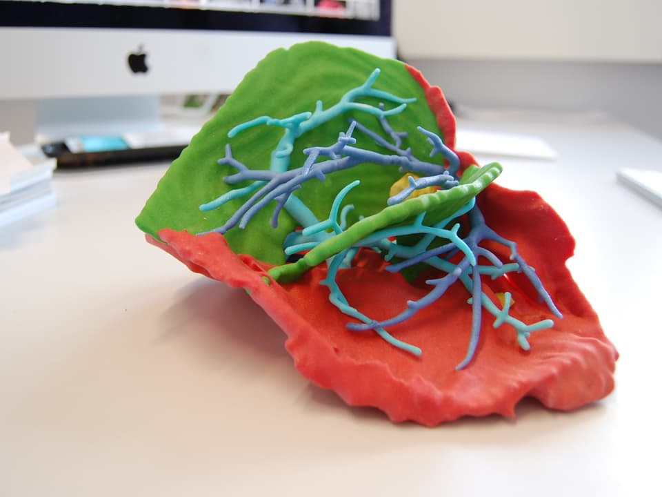 Ein 3D-Modell einer Leber.