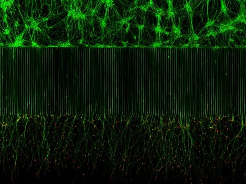 motorischen Neuronen