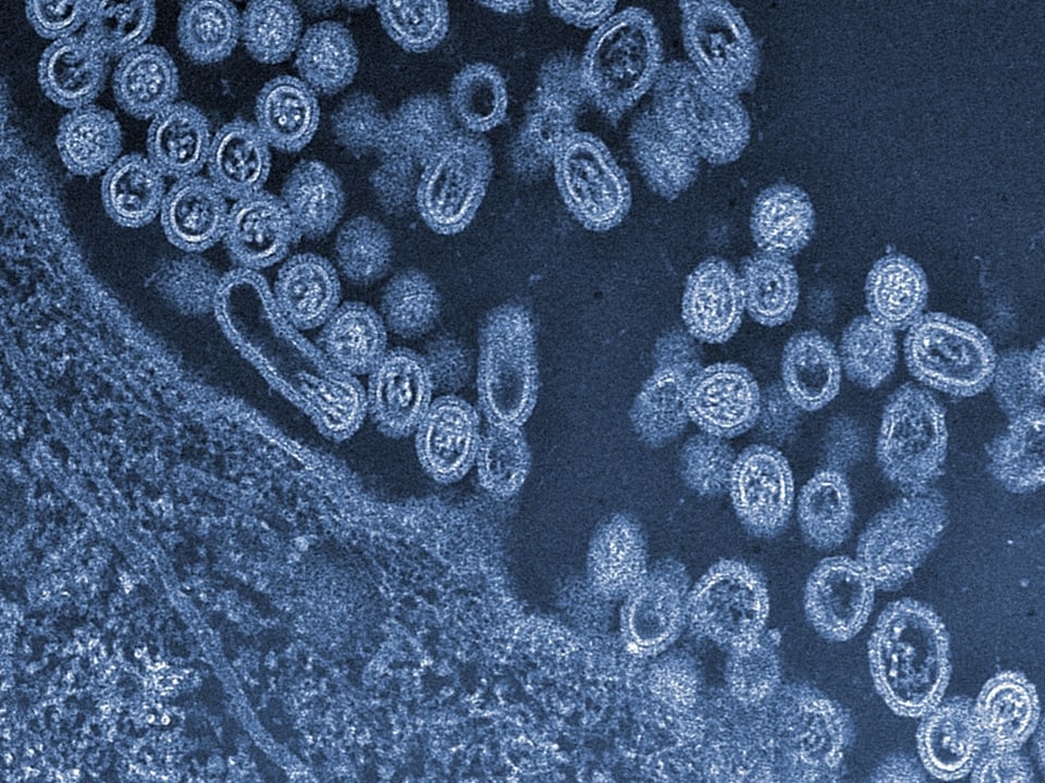 Mikroskopische Aufnahme des H7N9-Virus.