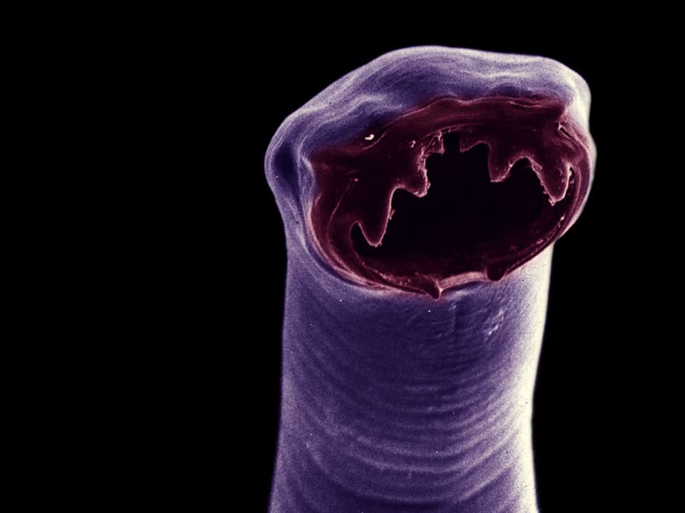 Mikroskopaufnahme eines Hakenwurms