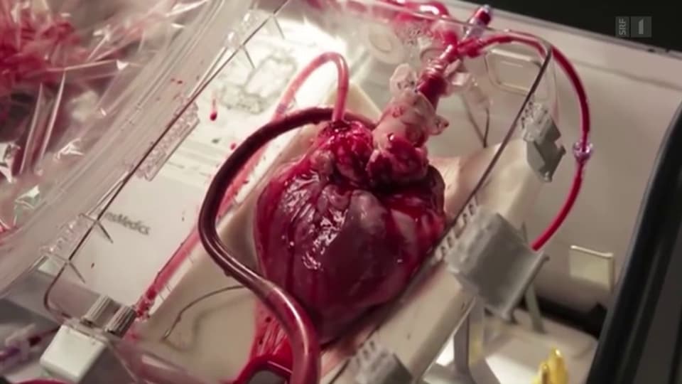 Organspende Herz Schlagt In Der Box Wissen Srf