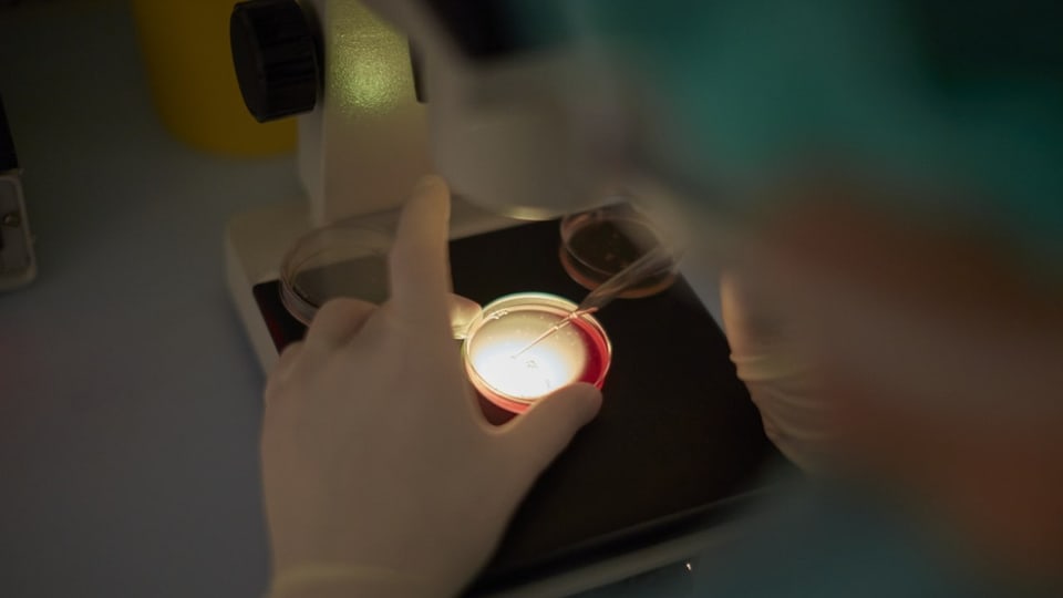 Während der Follikelpunktion wird die Follikelflüssigkeit, welche die Eizelle umgibt, im Reagenzröhrchen aufgefangen.