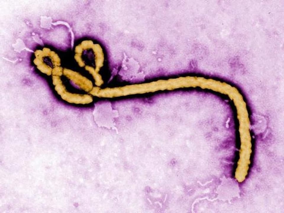 Eingefärbte Rasteraufnahme des Ebola-Virus