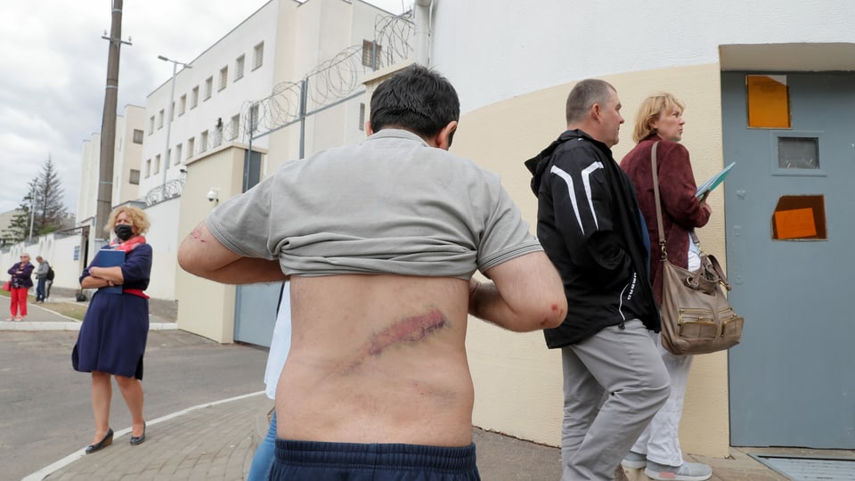 Mann mit verwundetem Rücken, Minsk 10.08.2020