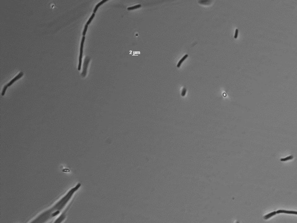 Auf dem Bild sind extremophile Bakterien unter dem Mikroskop zu sehen.