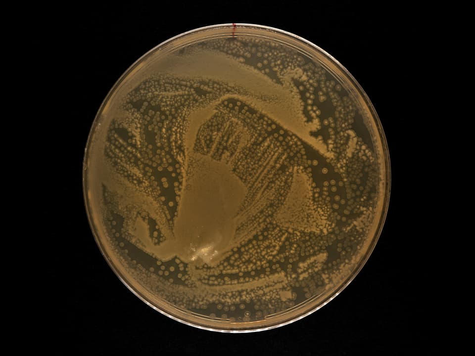 Petrischale mit braunem Bakterium