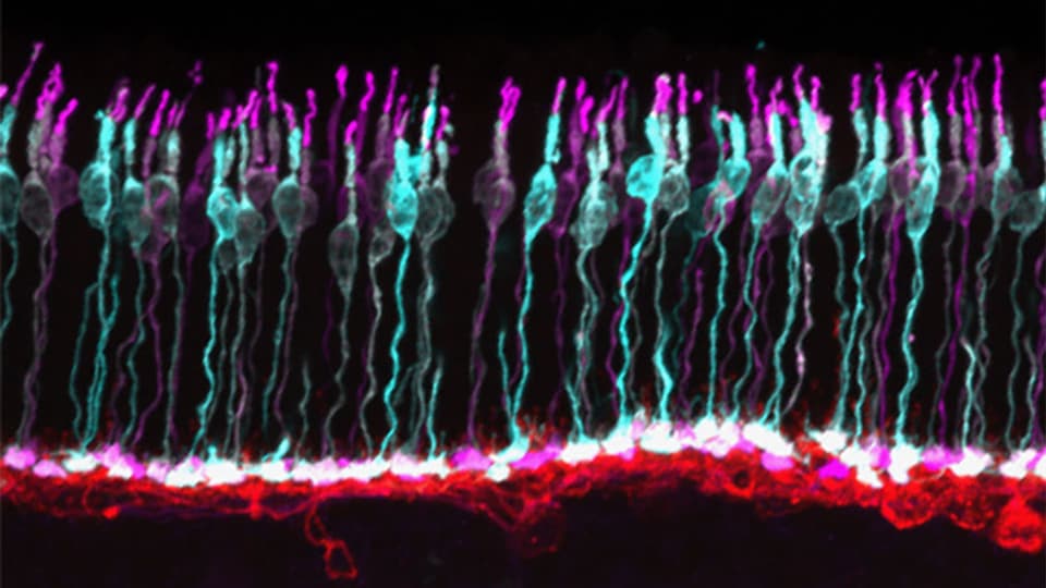 Nahaufnahme von bunt eingefärbten Sehzellen in der Retina