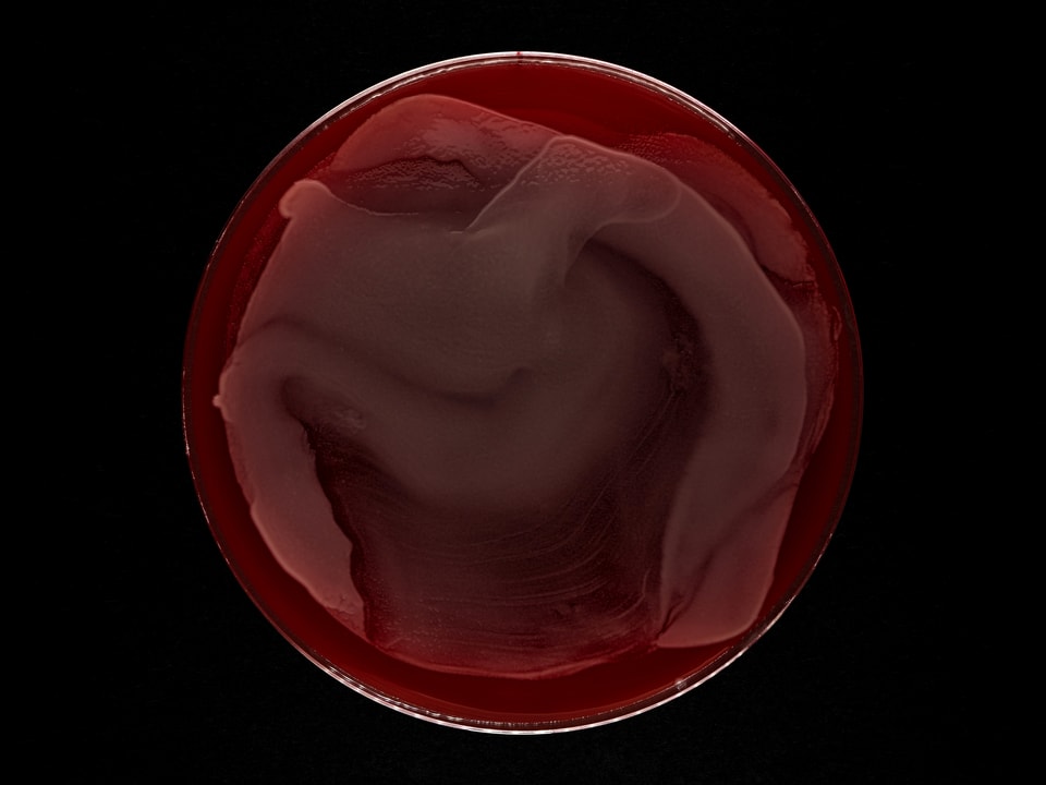 Petrischale mit rotem Pilz