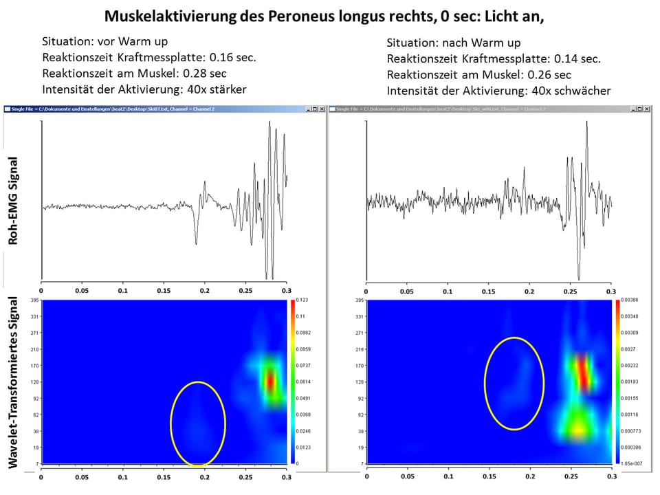 Messergebnis Unterschiede der Muskelaktivität vor und nach dem Warm-up