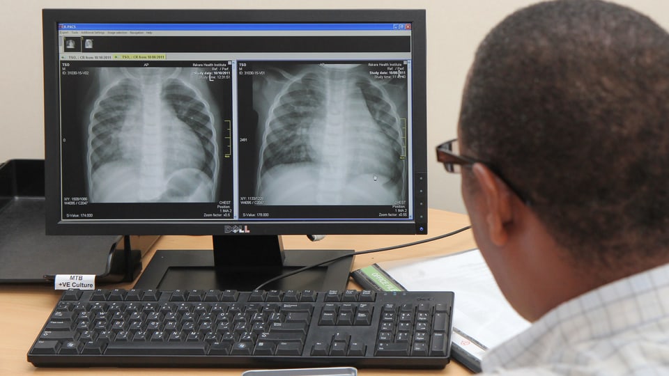 Ein Mann schaut auf einen Bildschirm, auf dem ein Röntgenbild einer Lunge zu sehen ist.