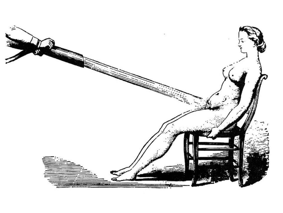 Zeichnung einer Frau auf einem Stuhl, auf deren Unterleib ein Wasserstrahl gerichtet ist.