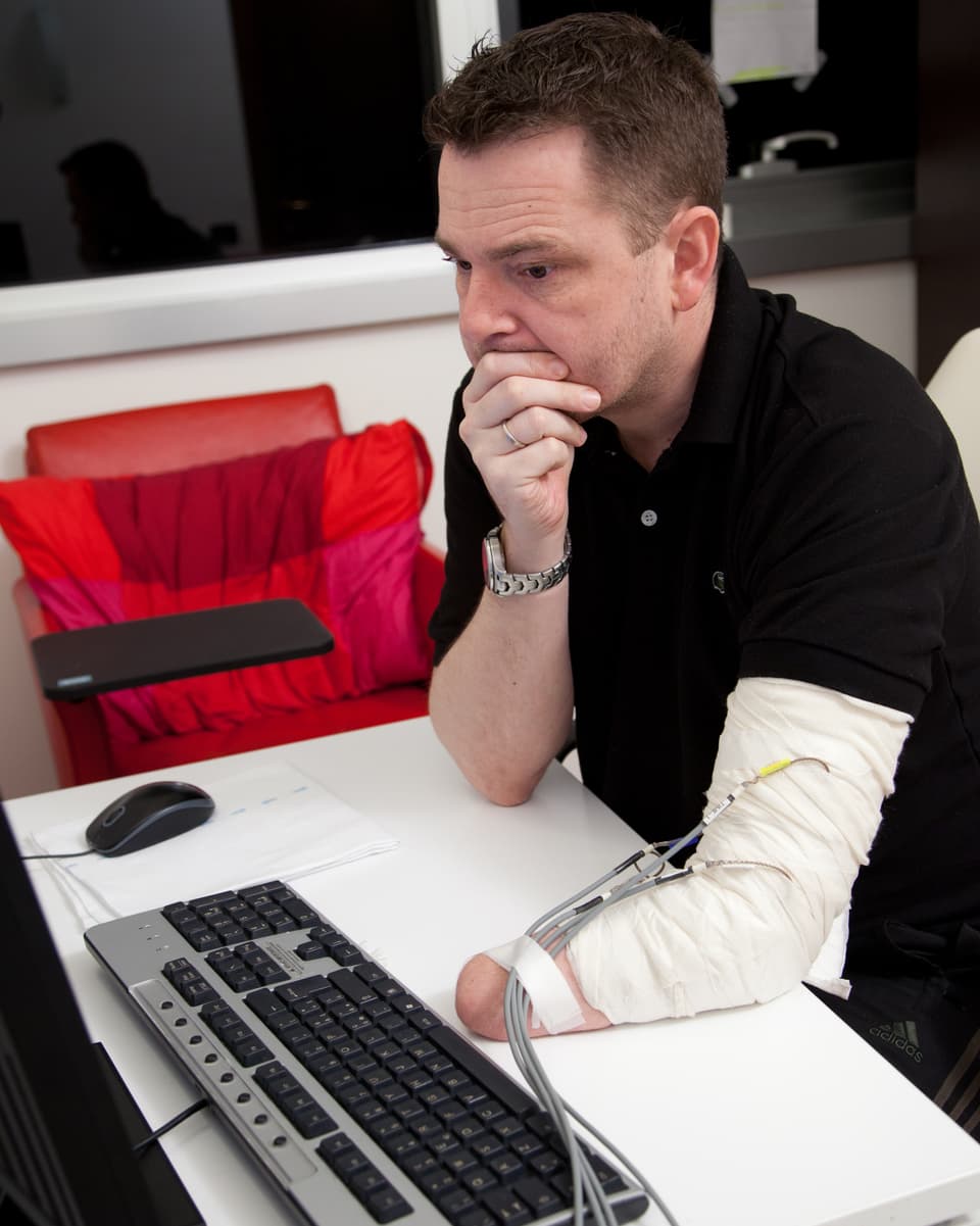 Dennis Sørensen sitzt vor seinem Computer, den Stumpf des Unterarms auf dem Schreibtisch.