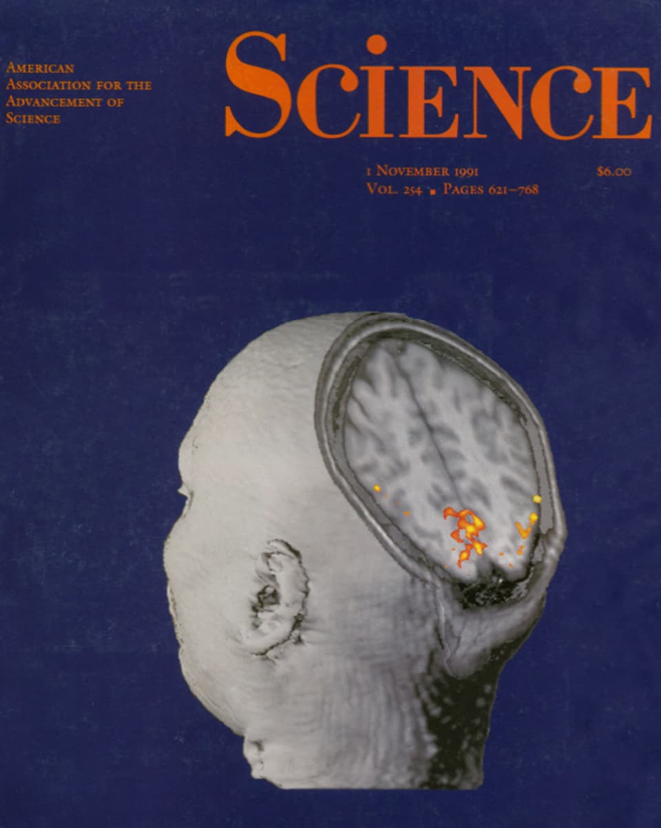 Titelblatt der Science-Ausgabe vom 1. November 1991 mit der eingefärbten MRI-Aufnahme eines menschlichen Gehirns