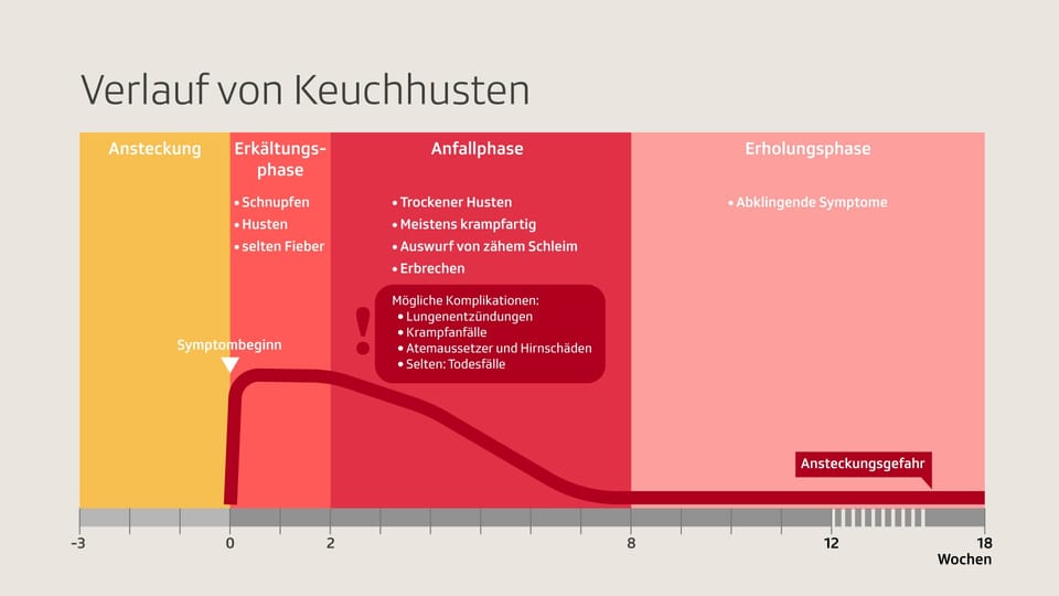 Was Sind Die 3 Stadien Von Keuchhusten