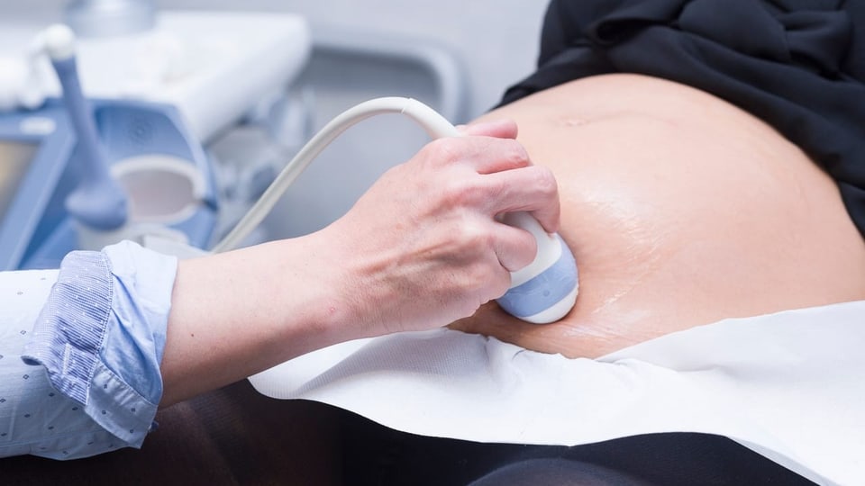 Ein Ultraschallgerät wird an den bauch einer Schwangeren gehalten.