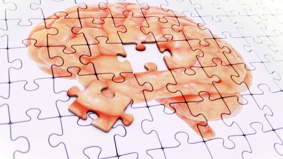 Ein Puzzlesteinchen ist aus einem Puzzle des Gehirns herausgenommen.