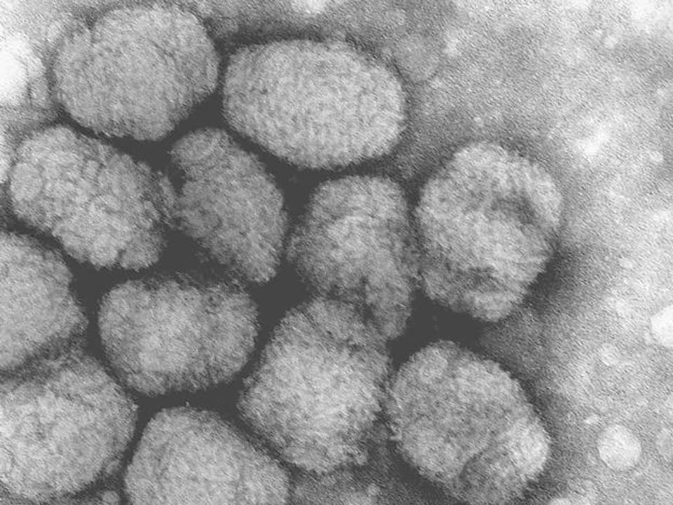 Variola-Viren auf einer mikroskopischen Abbildung.