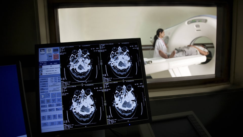 Computerbildschirm mit MRI-Bildern eines Kopfes, im Hintergrund ein Patient in einem MRI-Scanner