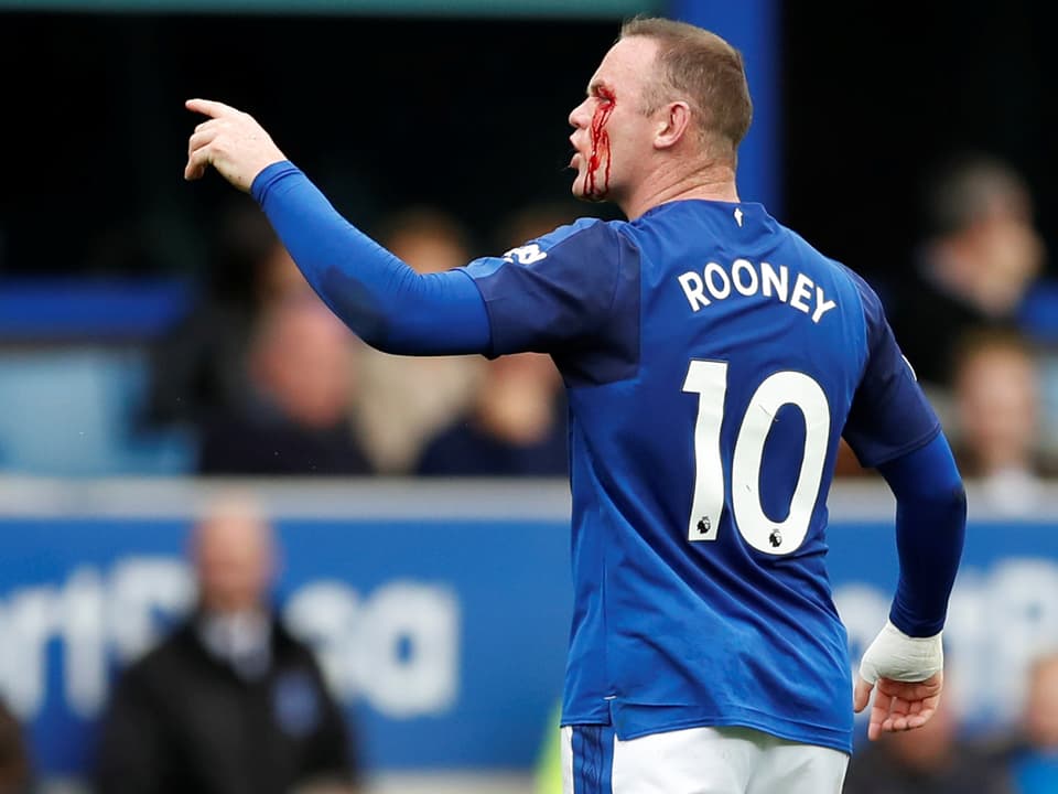 Evertons Wayne Rooney mit einer blutigen Wunde am Auge