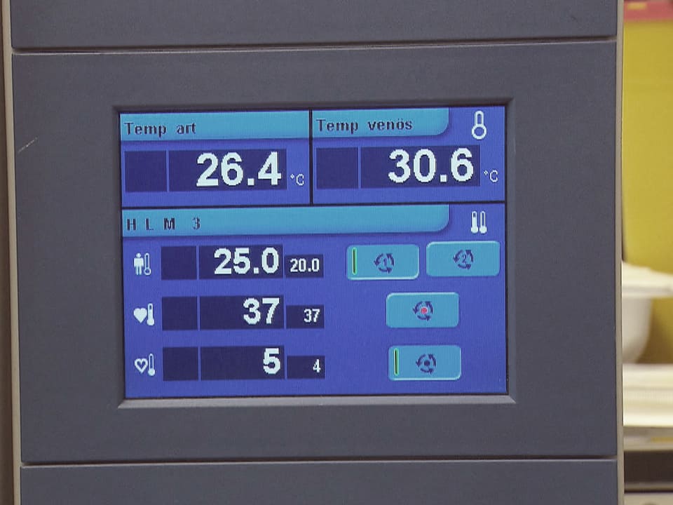 Anzeige-Bilderschirm mit der Körpertemperatur der Patientin.