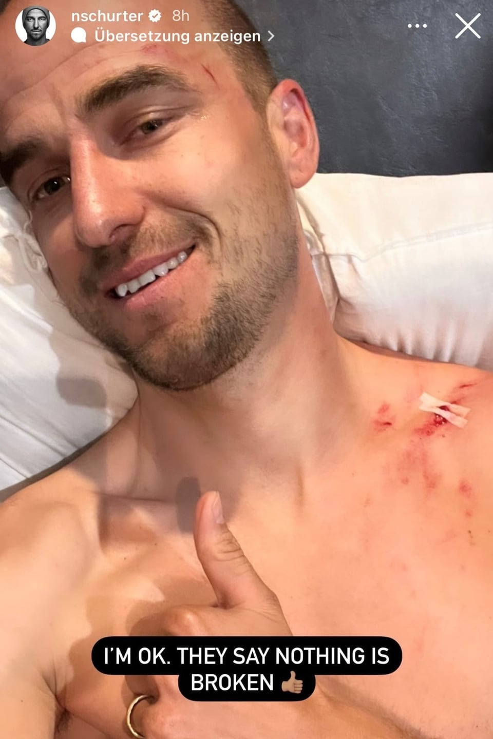 Gezeichnet Nino Schurter mit Daumen hoch und entblösstem Oberkörper. Eine blutige Wunde in der Region des Schlüsselbeins zu sehen