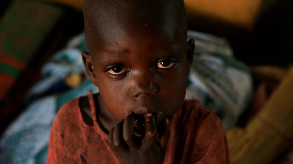 Hungerndes Kind im Südsudan.