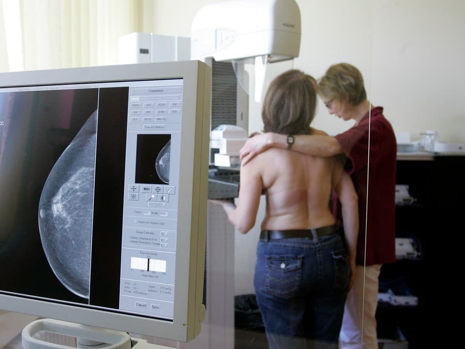 Eine Frau steht mit entblösstem Oberkörper während einer Mammographie.