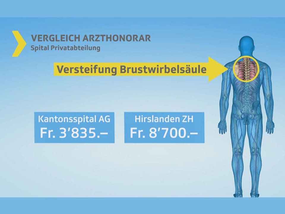 Grafik Preisvergleich Kantonsspital Hirslanden.