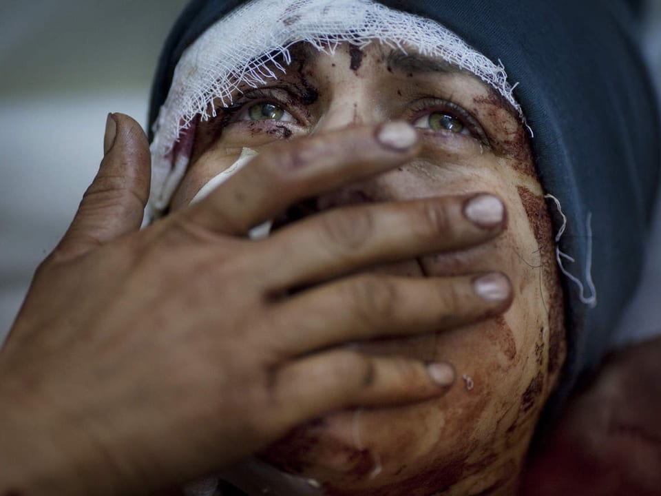 Portraitaufnahme einer schwer verletzten Frau, die weint. Sie hält sich die Hand vor das Gesicht.
