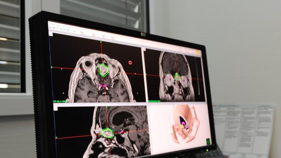 Monitor, welcher verschiedene Hirnscanns zeigt