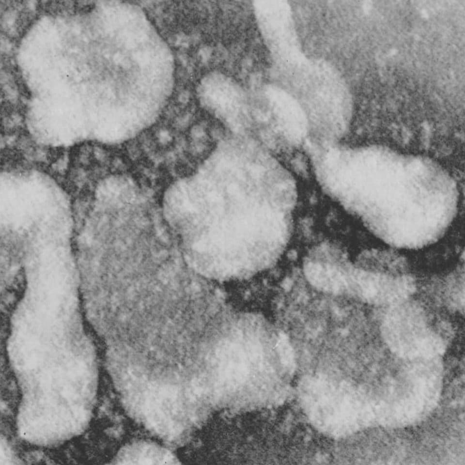 Mikroskopaufnahme des Coronavirus. 