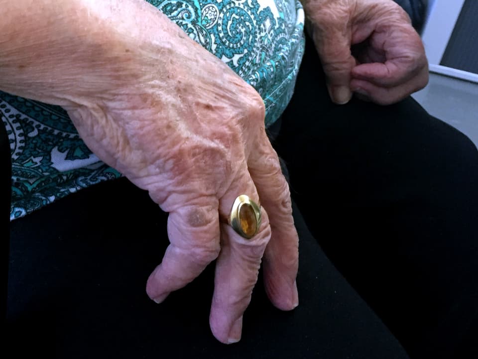 Hand mit Ring einer älteren Patientin.