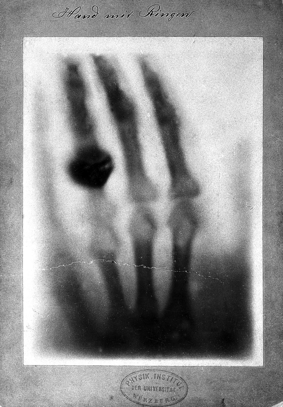 Röntgenaufnahme eienr Hand mit Ring.